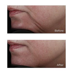 Стягащ серум против бръчки и разширени пори Perricone High Potency Classics Face Firming Serum 59ml