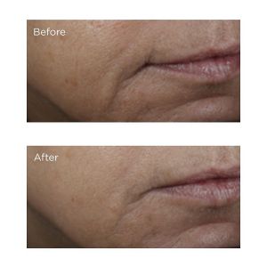 Изсветляващ лифтиращ серум с витамин С Perricone Vitamin C Ester Brightening Amine Face Lift 59ml