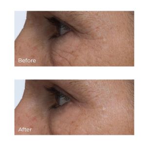 Подмладяващ серум с витамин С и пептиди Perricone Cold Plasma Plus+ Advanced Eye Cream 15ml