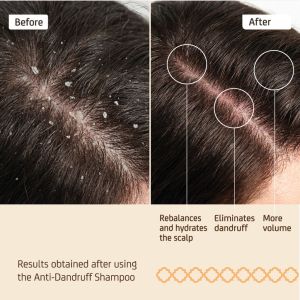 Ежедневен шампоан против пърхот NuggelaSule Epigenetic Shampoo Anti-Dandruff 250ml