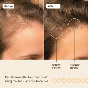 Ампули против косопад с гликоген NuggelaSule Effective Anti-Hair Loss Ampoules 8x10ml