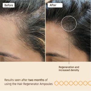 Регенерираща ампула за стимулиране растежа на косата NuggelaSule Hair Regenerator Ampoules 10ml