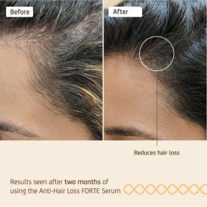 Интензивен серум против косопад NUGGELA & SULÉ Anti-Hair Loss Serum Forte 70 ml