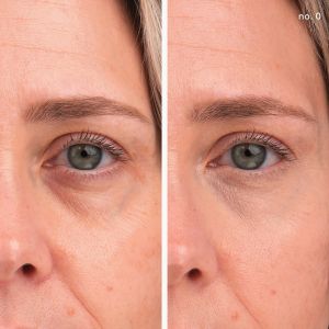 Коректор за зоната под очите SPF20/30 Jane Iredale Enlighten Plus Under-eye Concealer